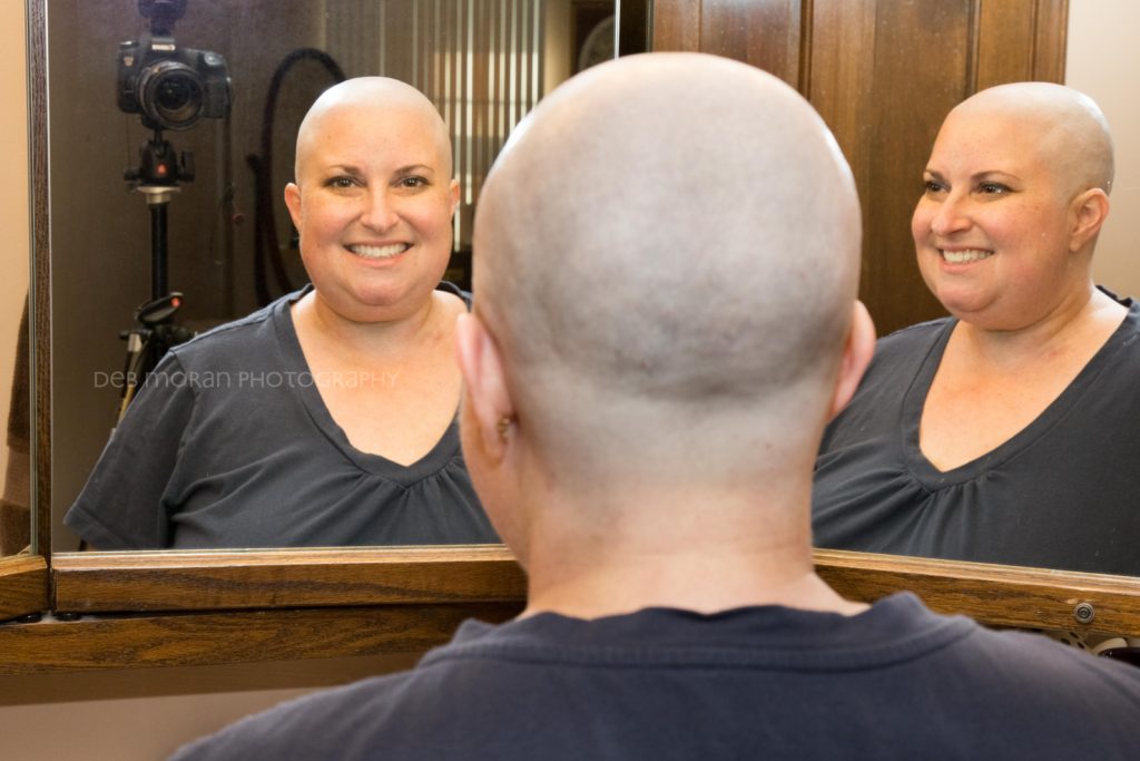 Bald and Beautiful